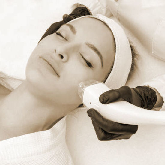 Picture of Gesichtslaserbehandlung